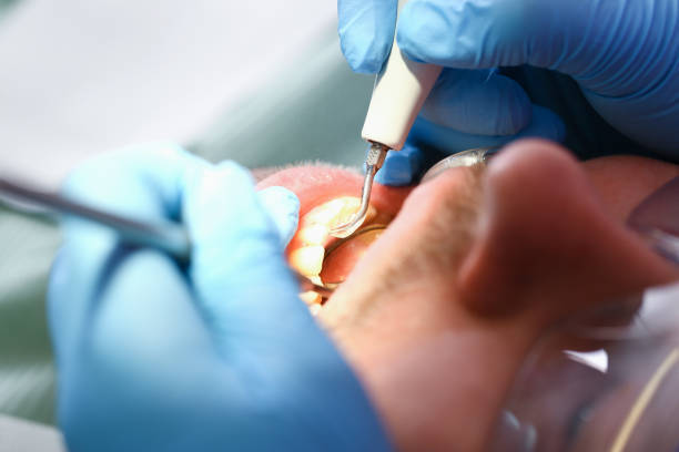 Best Emergency Tooth Extraction  in Red Springs, NC